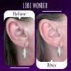 Lobe Wonder The ORIGINAL Earring Support Patches 360 Clear & Latex-Free view 3