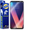 ArmorSuit MilitaryShield [Case Friendly] Screen Protector for LG V30 - Anti-Bubble HD Clear Film view 1