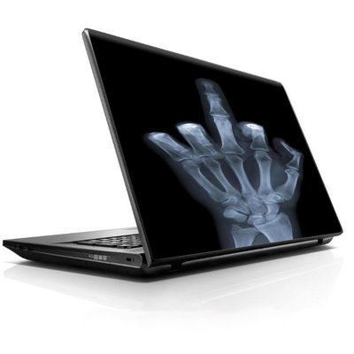 15 15.6 inch Laptop Notebook Skin Vinyl Sticker Cover Decal Fits 13.3" 14" 15.6" 16" HP Lenovo Apple Mac Dell Compaq Asus Acer/Hand Sign x-ray #1