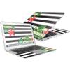 MightySkins Skin Compatible with Apple MacBook Air 13" (2017) - Tropical Stripes | Protective, Durable, and Unique Vinyl Decal wrap Cover | Easy to Apply, Remove, and Change Styles | Made in The USA view 1