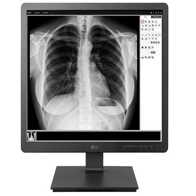 LG 19HK312C-B 19" Clinical Review Monitor, 1.3MP HD Resolution Images, Plastic Housing, DICOM Part 14 Compatible, Flicker Safe, Two-Way Pivot, 1280 x 1024 Resolution, 5:4 Aspect Ratio