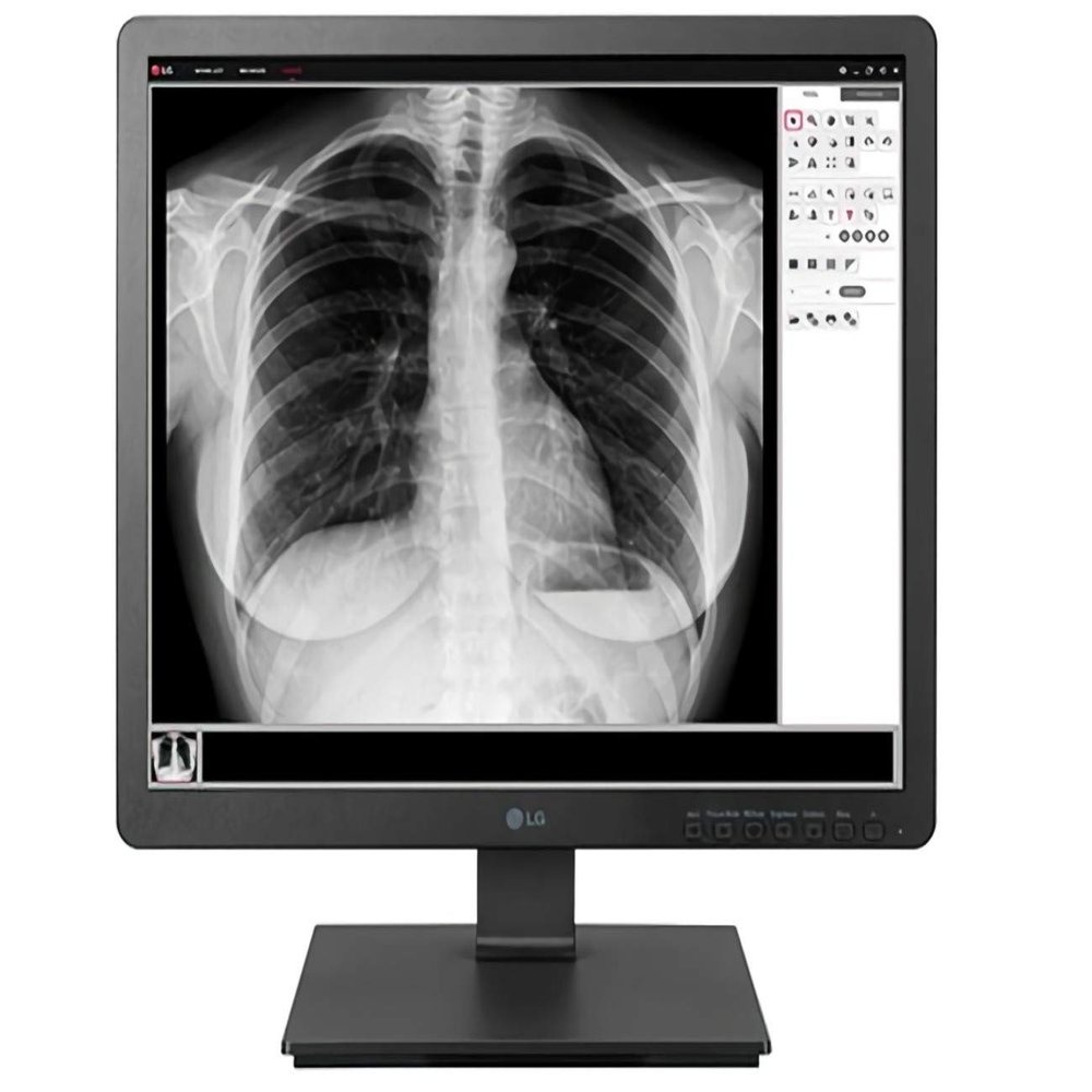 LG 19HK312C-B 19" Clinical Review Monitor, 1.3MP HD Resolution Images, Plastic Housing, DICOM Part 14 Compatible, Flicker Safe, Two-Way Pivot, 1280 x 1024 Resolution, 5:4 Aspect Ratio