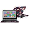 MightySkins Carbon Fiber Skin for HP Pavilion X360 15.6" (2016) - Skulls N Roses | Protective, Durable Textured Carbon Fiber Finish | Easy to Apply, Remove, and Change Styles | Made in The USA view 1