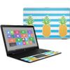 MightySkins Carbon Fiber Skin for HP 17T Laptop 17.3" (2017) - Beach Towel | Protective, Durable Textured Carbon Fiber Finish | Easy to Apply, Remove, and Change Styles | Made in The USA view 1