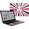 MightySkins Carbon Fiber Skin for HP 15T Laptop 15.6" (2017) - Pink Star Rays | Protective, Durable Textured Carbon Fiber Finish | Easy to Apply, Remove, and Change Styles | Made in The USA view 1
