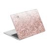Head Case Designs Officially Licensed Nature Magick Sparkling Rose Gold 2 Rose Gold Marble Glitter Vinyl Sticker Skin Decal Cover Compatible with MacBook Pro 13.3" A1708 view 1