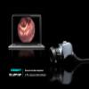 ESC Medicams Endoscopy Camera & LED Light Source for Rigid ENT (118.000) view 3