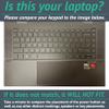 MightySkins Carbon Fiber Skin Compatible with HP Envy x360 15" (2021) - Pretty Pineapple | Protective, Durable Textured Carbon Fiber Finish | Easy to Apply | Made in The USA view 2