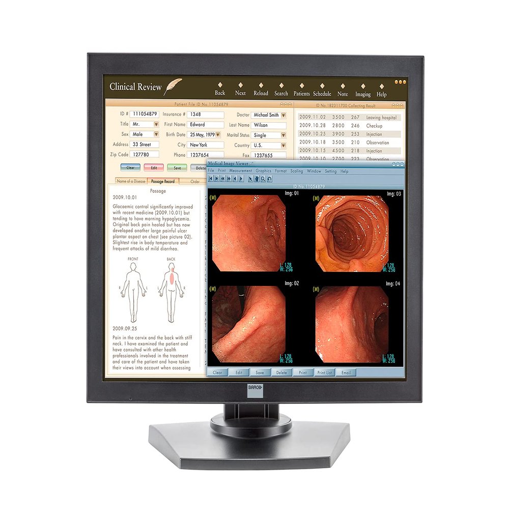 Monitors Barco MDRC-1119 1MP 19" Color Clinical Review Display (K9301800A)