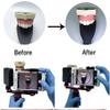 Dental Fill Light Flash Photography Kit Teeth Photography Tool view 2