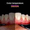 Dental Fill Light Flash Photography Kit Teeth Photography Tool view 4