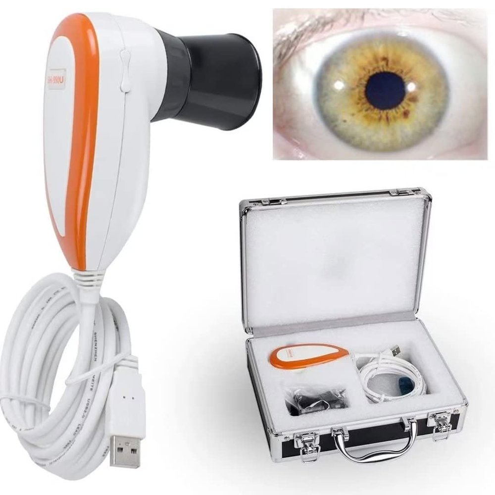 ZWEBY Iris Analysis Camera, 5.0 MP USB Iris Analyzer Iridology Camera, 5.0 M Pixel USB Left/Right Lamp Analyzer/Analysis Iridology Camera with Pro Iris Software