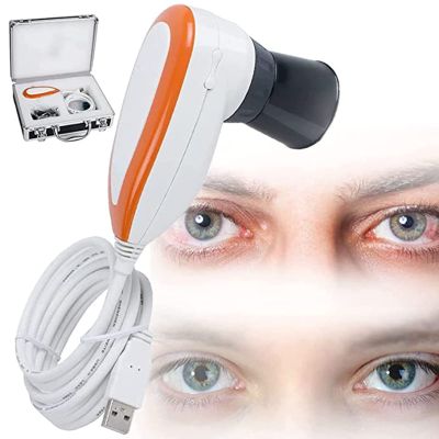 Iris Analysis Camera, 5.0 MP USB Iris Analyzer Iridology Camera, with HD 30x Iris Lens and Driver-Free Analysis Software Eye Iridology Camera for Beauty Salons, Health Clubs Iridology