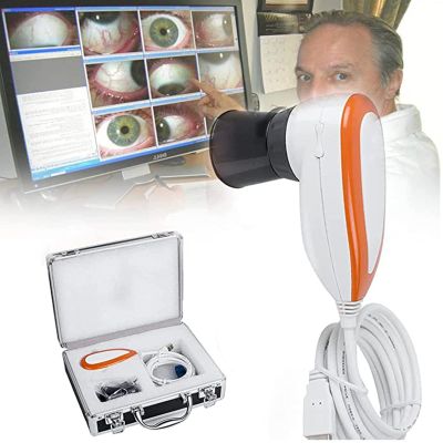SSQUZA Iris Analysis Camera,5 Million Pixel High Resolution 2560 * 1920 USB 2.0 Interface Iriscope Diagnostic Eye Camera with HD 30x Iris Lens, Iris Magnifier Eye Iris Camera