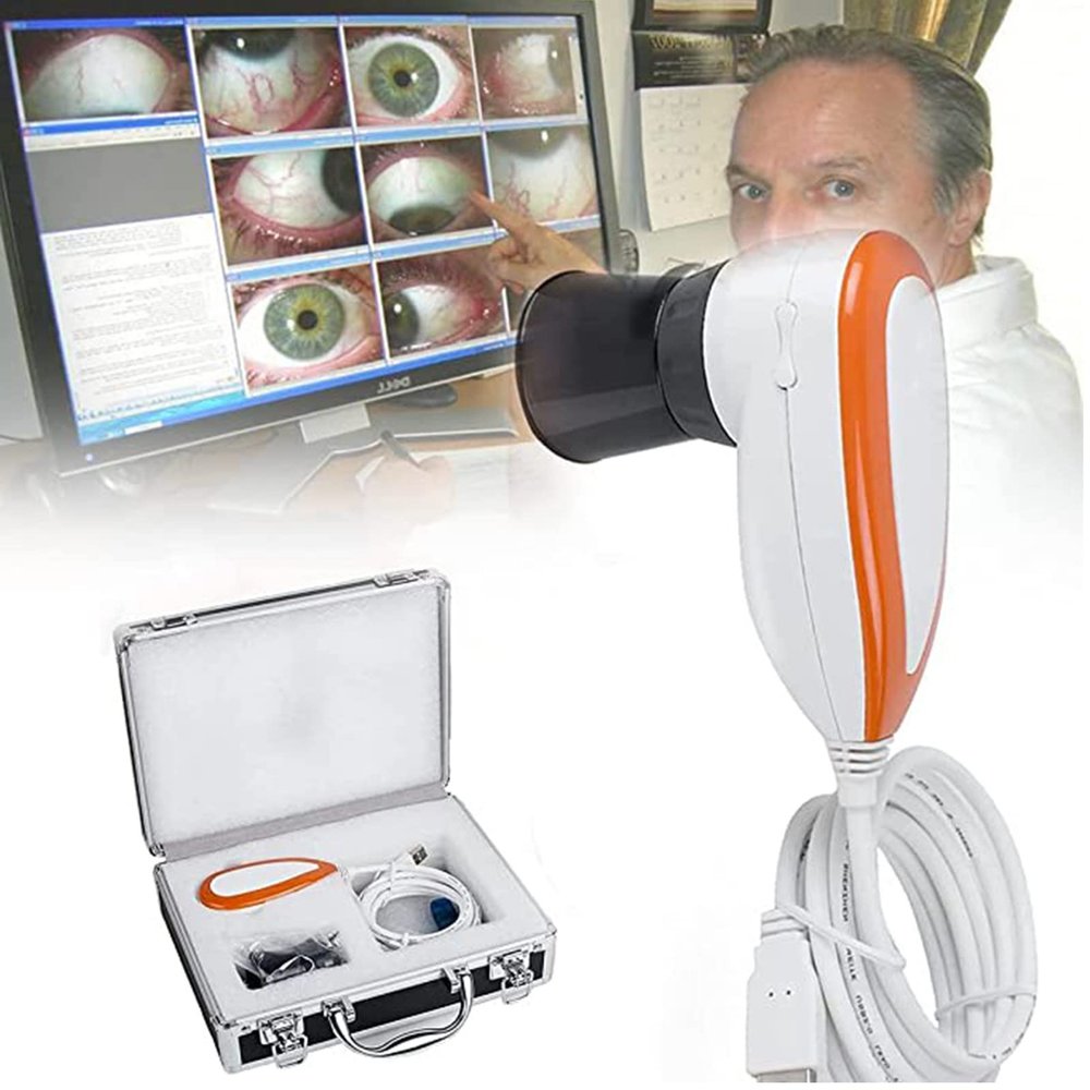 SSQUZA Iris Analysis Camera,5 Million Pixel High Resolution 2560 * 1920 USB 2.0 Interface Iriscope Diagnostic Eye Camera with HD 30x Iris Lens, Iris Magnifier Eye Iris Camera