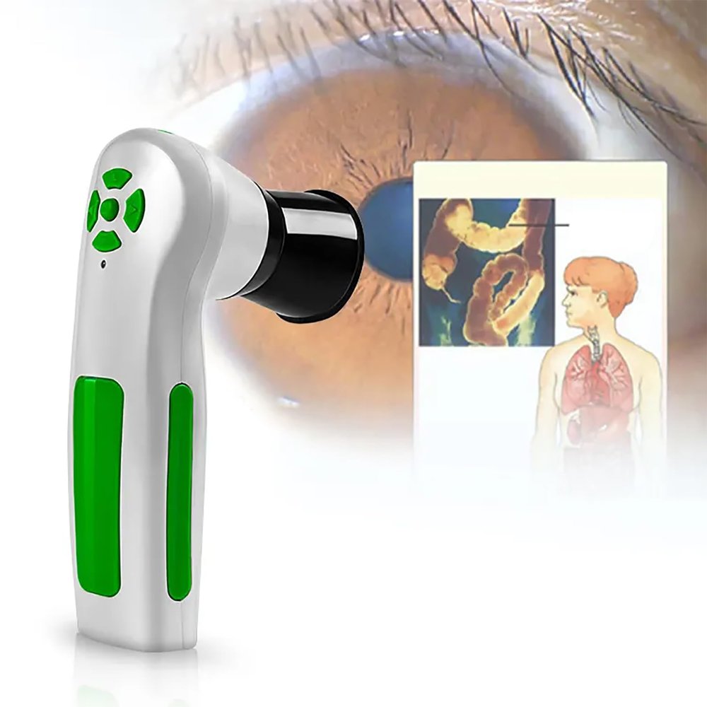 ERICAT Portable Iridology Camera, 2.0 MP USB Iris Analyzer with 12MP HD 30x Iris Lens and Driver-Free Analysis Software, Quickly Display Iris Status and Color Diagnostic Image, for Health Center, Spa