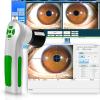 ERICAT Portable Iridology Camera, 2.0 MP USB Iris Analyzer with 12MP HD 30x Iris Lens and Driver-Free Analysis Software, Quickly Display Iris Status and Color Diagnostic Image, for Health Center, Spa view 4