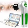 DaMga Iris Analysis Camera, USB2.0 Interface Portable Iris Detector, 12 Million Pixel Iris Detector Auto-Focus Iris Machine, Win7, Win8, Win10, Win11, Left and Right Lighting Switch view 1