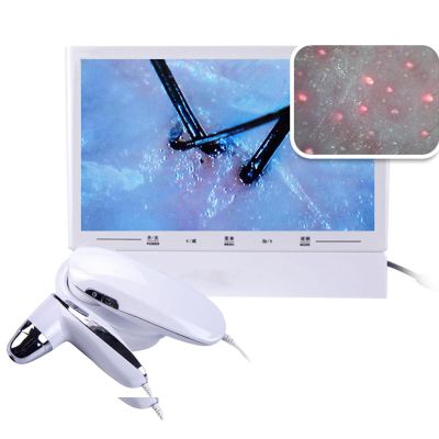 MTTXY Skin Hair Scalp Detector, 11Inch LCD Screen Digital Skin Detector, 50X 200X HD Analyzer Microscope Skin Care Tool -for Home Salon Use