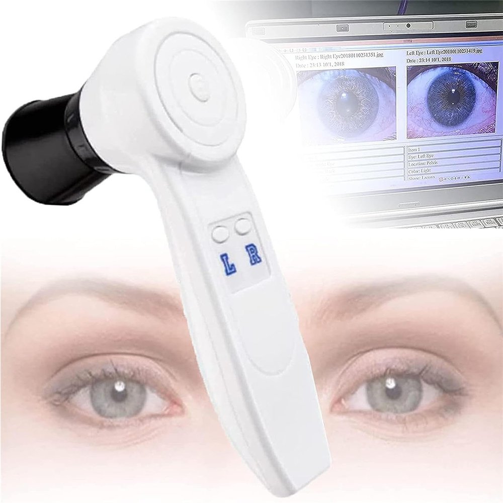 HEAXIY Iridology Camera, 5.0 MP Iris Analyser Iridoscope Analysis Camera, Portable Iris Detector with HD 30x Iris Lens, Iris Magnifier Eye Iris Camera