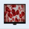 CX3 5.0MP HDMI Microscope Camera with 11.6-Inch TFT Display view 1
