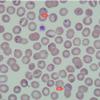 Plasmodium Falciparum Trophozoite Smear Prepared Microscope Slides 1 Pieces view 2