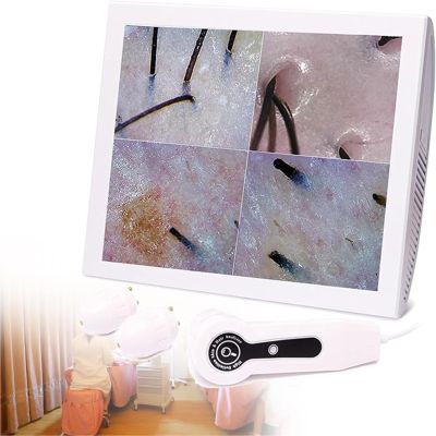 5-200X Skin Hair Scalp Detector,Digital Microscope Digital Microscope Skin Analyser Wireless Digital Microscope Skin Analyzer
