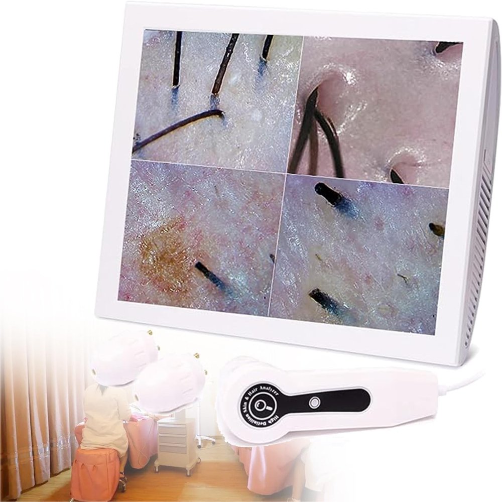 5-200X Skin Hair Scalp Detector,Digital Microscope Digital Microscope Skin Analyser Wireless Digital Microscope Skin Analyzer