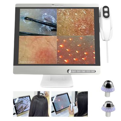 aigahealzhou 15.5 Inch Scalp Microscope, Skin Analysis Machine with16G Disk, 50X / 200X Dual Probes, Hair Follicle Detector for Hair Salon, SPA Beauty Shop