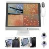 aigahealzhou 15.5 Inch Scalp Microscope, Skin Analysis Machine with16G Disk, 50X / 200X Dual Probes, Hair Follicle Detector for Hair Salon, SPA Beauty Shop view 1