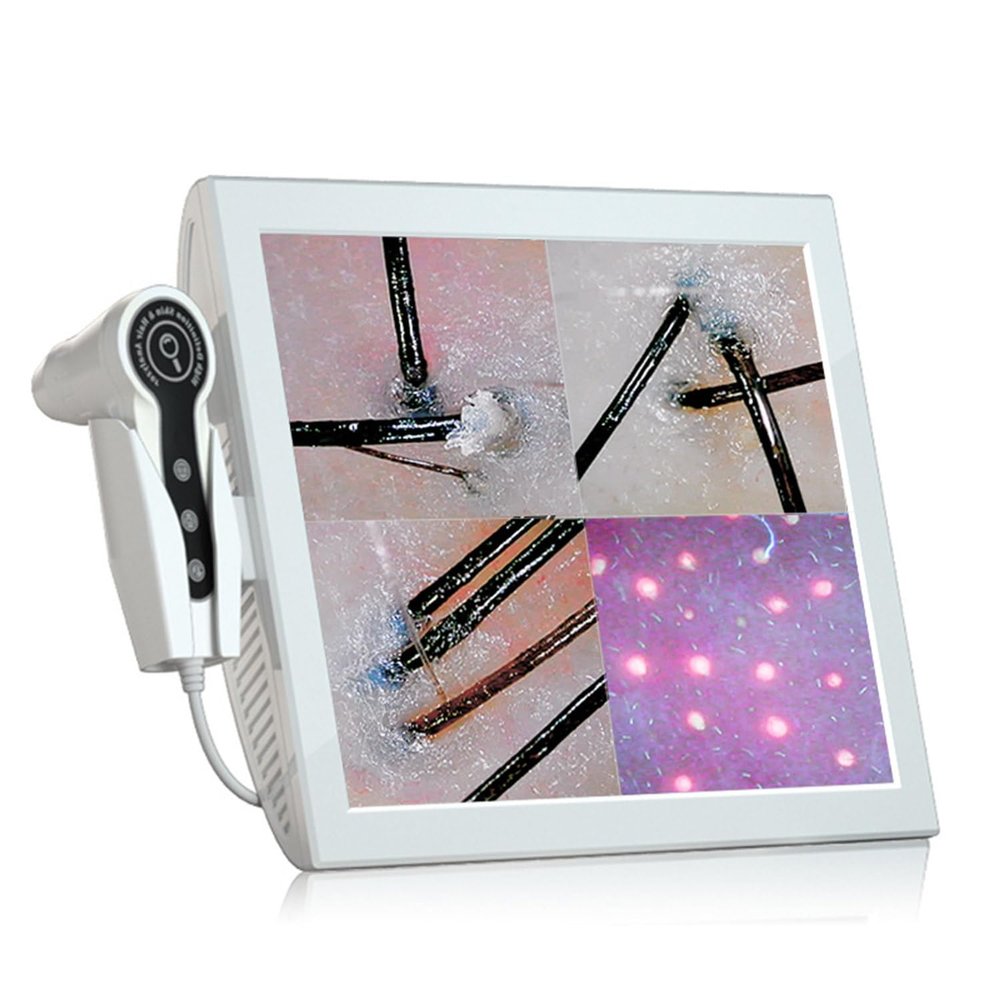 15-inch Skin Hair Analyser, HD LCD Screen Microscope Tester Skin Hair Scalp Detector Skin Scanner Skin Scope Diagnosis Machine 2 Million Pixel Hd Magnifier