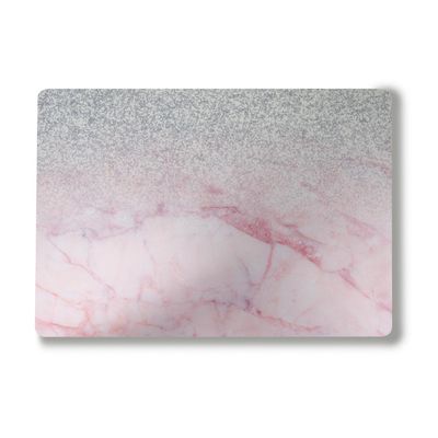 Laptop Skin Compatible with Surface Laptop 7 15" (2024) - Girly Marble Dazzle - Premium 3M Vinyl Protective Wrap Decal Cover - Easy to Apply | Crafted in The USA by MightySkins