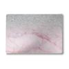 Laptop Skin Compatible with Surface Laptop 7 15" (2024) - Girly Marble Dazzle - Premium 3M Vinyl Protective Wrap Decal Cover - Easy to Apply | Crafted in The USA by MightySkins view 1