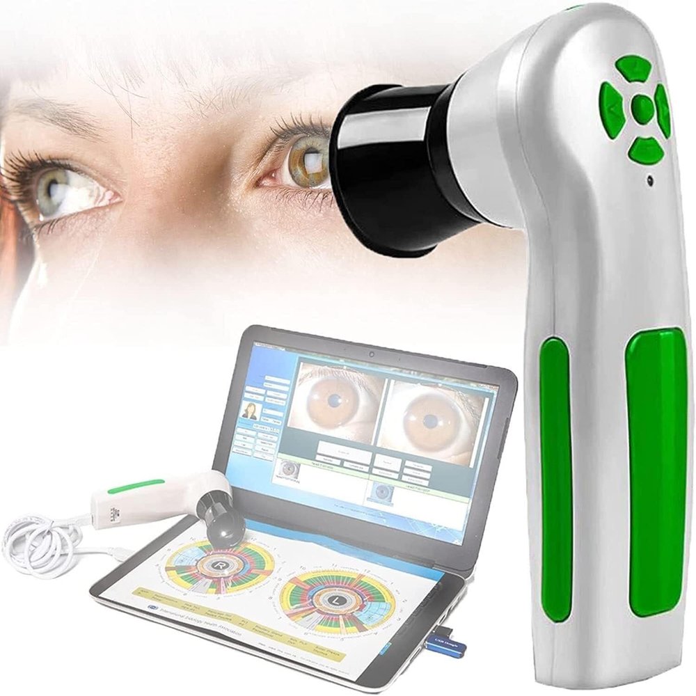 12 MP Auto Focus Iris Detector,Iris Analysis Camera,High Resolution 4032 * 3024 Iriscope Diagnostic Eye Camera with HD 30x Iris Lens and Driver-Free Analysis Software