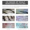 11-inch Hair Follicle Detector, Follicles Oil Moisture Tester Skin Pore Pigment Amplification Analyzer Skin Pigment Tester, 4 Spectrum Detection, 50X-200X view 4