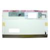 11.6 inch LCD Screen for 721, 148 753 ZA3 200 Laptop LED Screen Replacement Display 40 Pin Matrix view 2