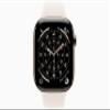Apple Watch Series 11 [GPS + Cellular, 46mm] Gold Titanium Case with Starlight Sport Band, M/L (Renewed) view 2