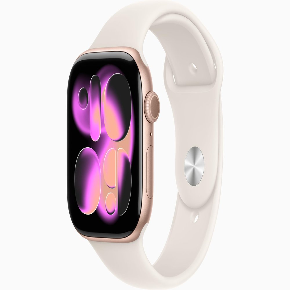 Apple Watch Series 11 [GPS + Cellular, 46mm] Rose Gold Aluminum Case with Starlight Sport Band, M/L (Renewed)