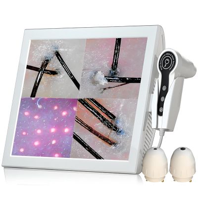 15 in Skin Scalp Hair Follicle Detector,4 Screen Image Comparison,50X/200X High-Resolution Hair Scalp Analysis Device,for Salon Spa Home Beauty